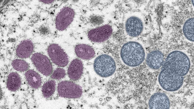 This digitally-colorized electron microscopic (EM) image depicted monkeypox virus particles, obtained from a clinical sample associated with the 2003 prairie dog outbreak. It was a thin section image from of a human skin sample. On the left were mature, oval-shaped virus particles, and on the right were the crescents, and spherical particles of immature virions.